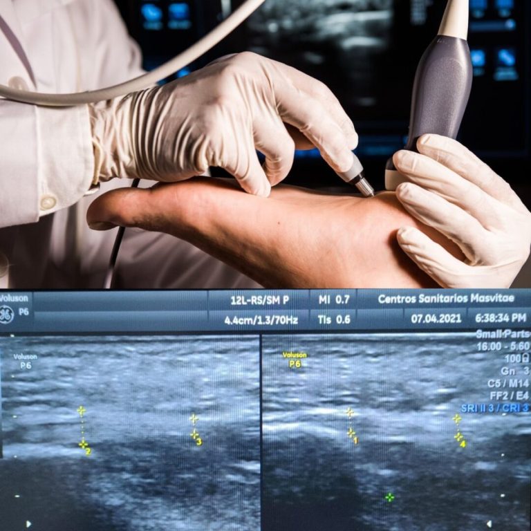 210701Masvitae_Blog_Infiltraciones-1080x1080