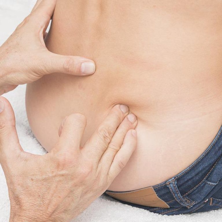 Espondilitis anquilosante