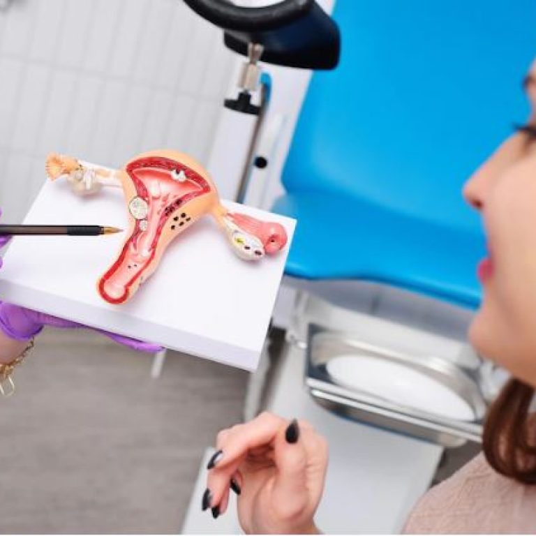 revision ginecologica