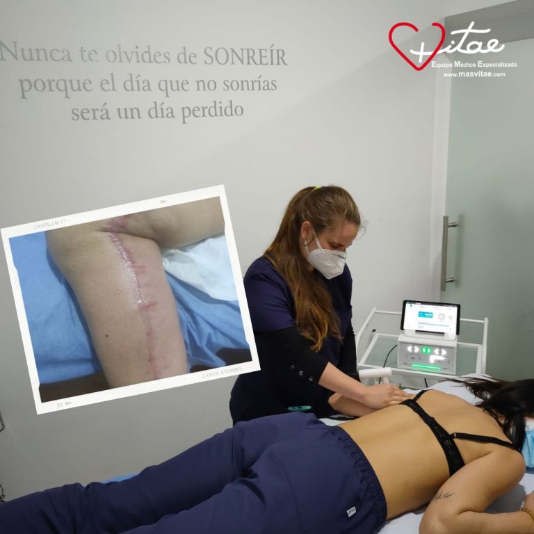 Fisioterapia estética o dermatofuncional